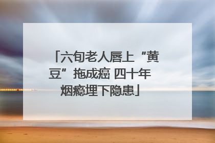 六旬老人唇上“黄豆”拖成癌 四十年烟瘾埋下隐患